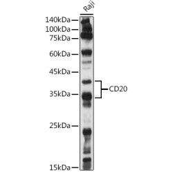 CD20 Rabbit pAb