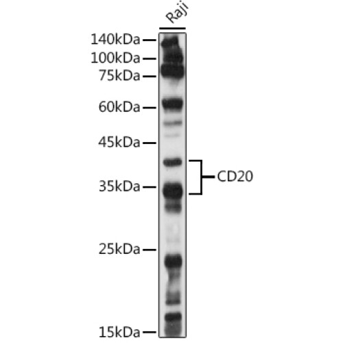 CD20 Rabbit pAb