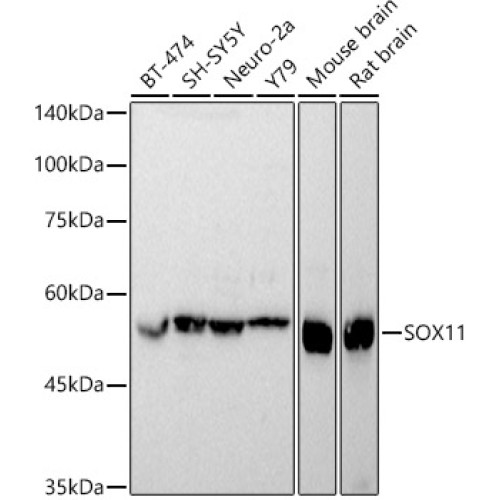 SOX11 Rabbit pAb