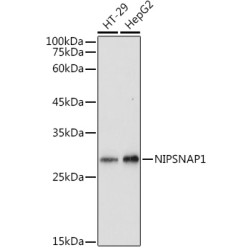 NIPSNAP1 Rabbit pAb