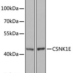 [KO Validated] CSNK1E Rabbit pAb