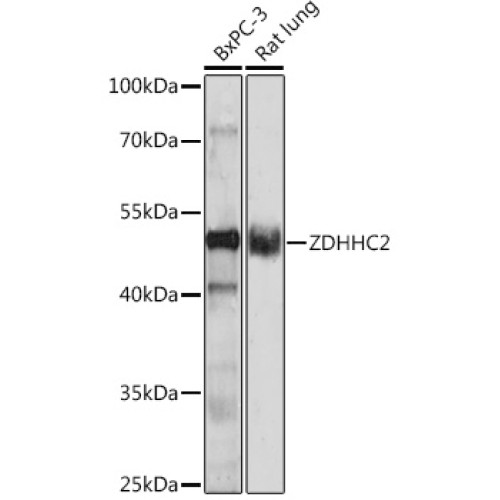 ZDHHC2 Rabbit pAb
