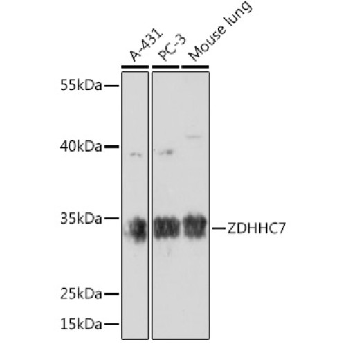 ZDHHC7 Rabbit pAb