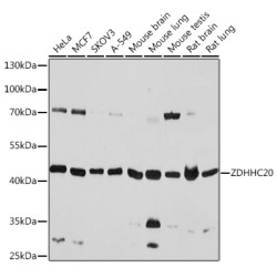 ZDHHC20 Rabbit pAb