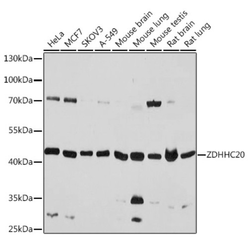 ZDHHC20 Rabbit pAb