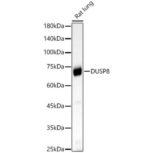 DUSP8 Rabbit pAb