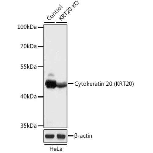 [KO Validated] Cytokeratin 20 (KRT20) Rabbit pAb