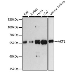 AKT2 Rabbit pAb