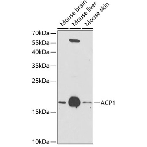 ACP1 Rabbit pAb
