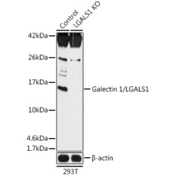 [KO Validated] Galectin 1/LGALS1 Rabbit pAb