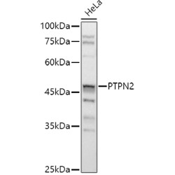 [KO Validated] PTPN2 Rabbit pAb