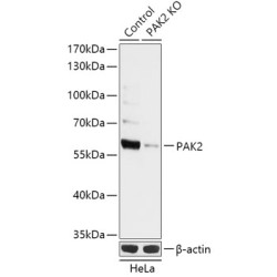 [KO Validated] PAK2 Rabbit pAb