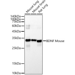 BDNF Mouse mAb