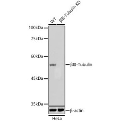 βIII-Tubulin Mouse mAb