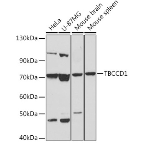 TBCCD1 Rabbit pAb