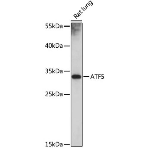 ATF5 Rabbit pAb