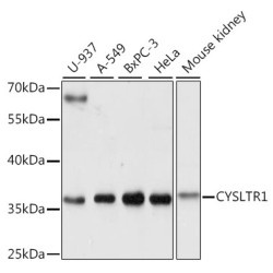 CYSLTR1 Rabbit pAb