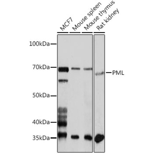 PML Rabbit pAb