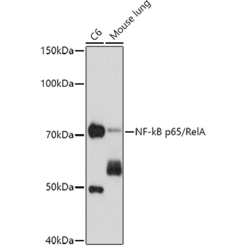 NF-kB p65/RelA Mouse mAb