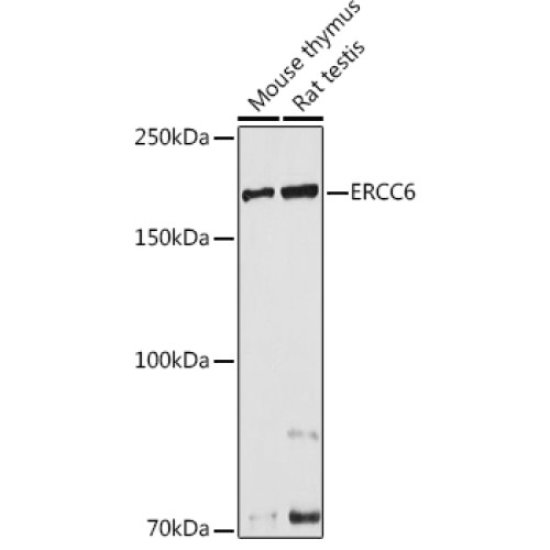 ERCC6 Rabbit pAb