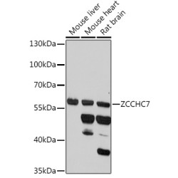 ZCCHC7 Rabbit pAb