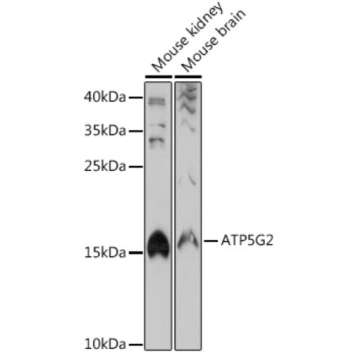 ATP5G2 Rabbit pAb
