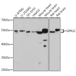 GPR22 Rabbit pAb
