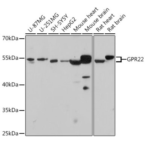 GPR22 Rabbit pAb