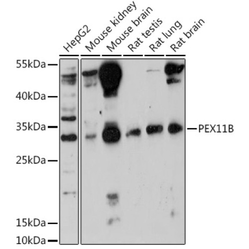 PEX11B Rabbit pAb