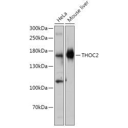 THOC2 Rabbit pAb