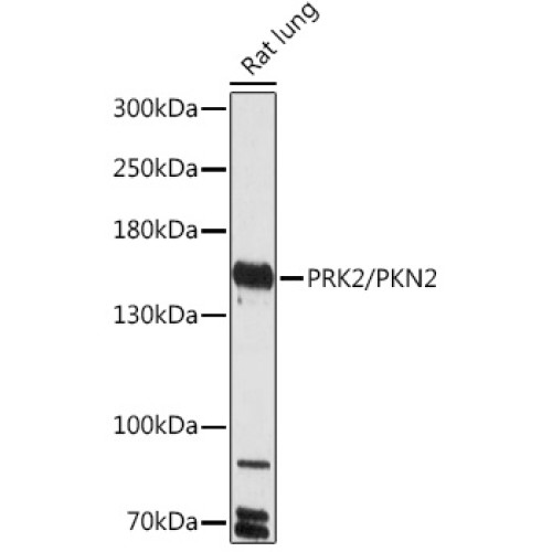 PRK2/PKN2 Rabbit pAb