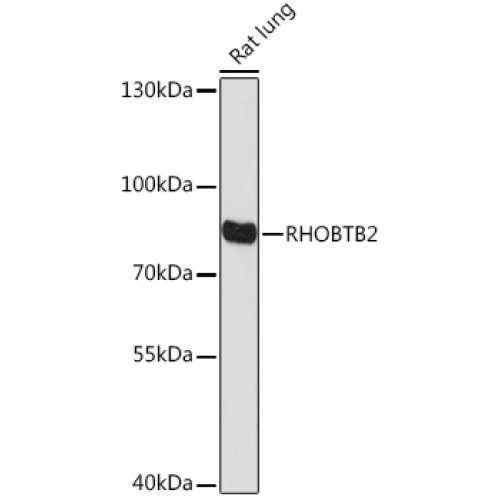 RHOBTB2 Rabbit pAb