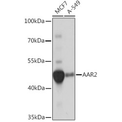 AAR2 Rabbit pAb