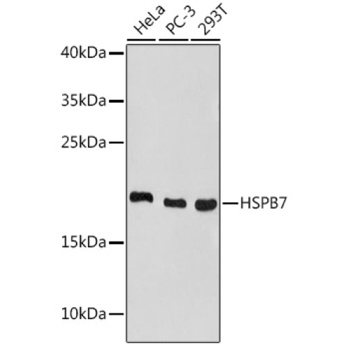 HSPB7 Rabbit pAb