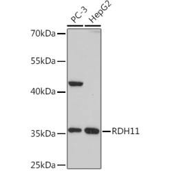 RDH11 Rabbit pAb