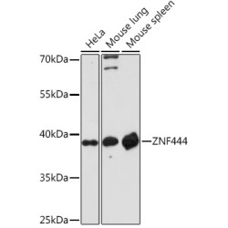 ZNF444 Rabbit pAb