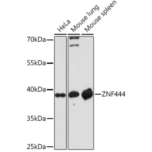 ZNF444 Rabbit pAb