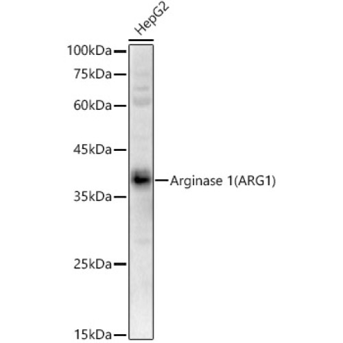Arginase 1 (ARG1) Rabbit pAb