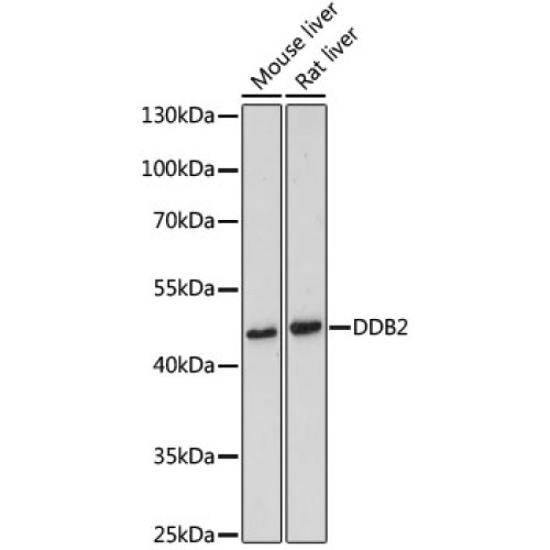 DDB2 Rabbit pAb
