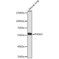 PANK2 Rabbit pAb