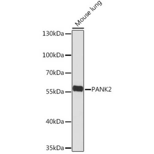 PANK2 Rabbit pAb