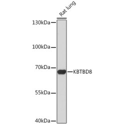 KBTBD8 Rabbit pAb