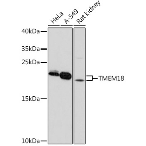 TMEM18 Rabbit pAb