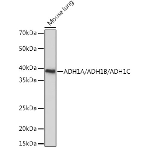 ADH1A/ADH1B/ADH1C Rabbit pAb