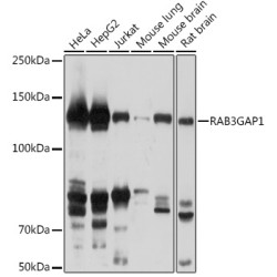 RAB3GAP1 Rabbit pAb