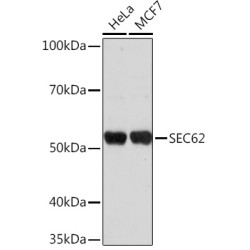 SEC62 Rabbit pAb