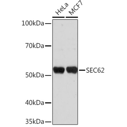 SEC62 Rabbit pAb