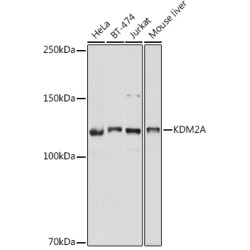 KDM2A Rabbit pAb