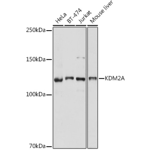 KDM2A Rabbit pAb