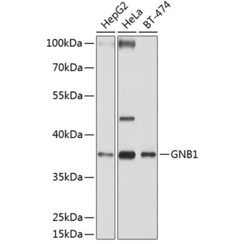 GNB1 Rabbit pAb